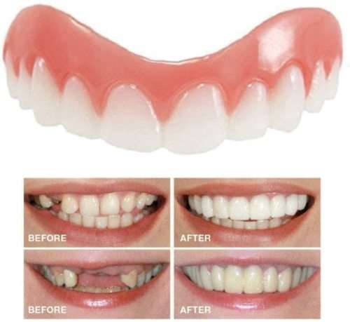 Instant Snap On Perfect Smile Veneers