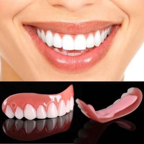 Instant Snap On Perfect Smile Veneers