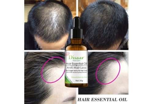 Disaar  Anti-Hair loss Hair Essential Oil Hair Growth Liquid
