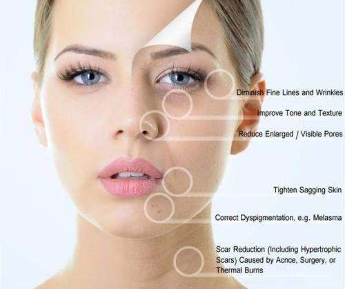 Wokali Gold Pure Collagen Anti - Wrinkle , Firming and Skin Rejuvenation Cream