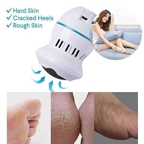HIGH POWERED and COMPACT CALLUS REMOVER and FOOT FILE WITH BUILT IN VACUUM