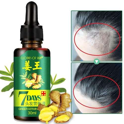 AMAZING 7DAYS GINGER GERMINAL HAIR RE - GROWTH SERUM