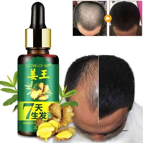 AMAZING 7DAYS GINGER GERMINAL HAIR RE - GROWTH SERUM