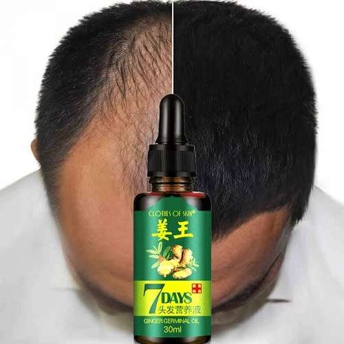 AMAZING 7DAYS GINGER GERMINAL HAIR RE - GROWTH SERUM