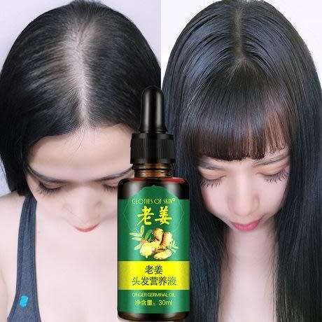 AMAZING 7DAYS GINGER GERMINAL HAIR RE - GROWTH SERUM