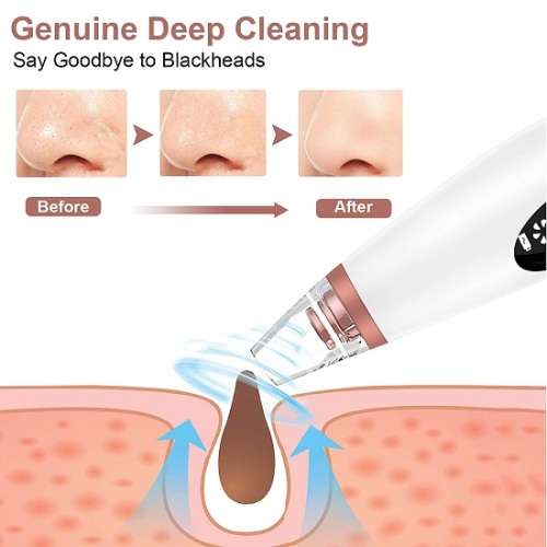 Rechargeable Multifunctional LED Vacuum Blackhead Remover and Deep Pore Cleaner