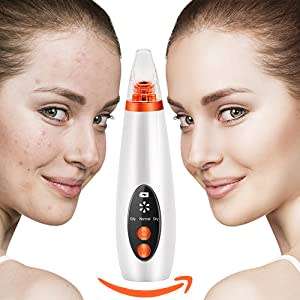 Rechargeable Multifunctional LED Vacuum Blackhead Remover and Deep Pore Cleaner