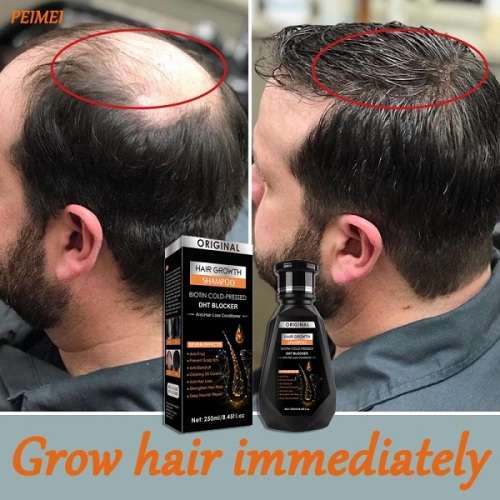 Brilliant Quick Grow Hair Re-Growth and Anti - Hair Loss  Shampoo and Conditioner combo