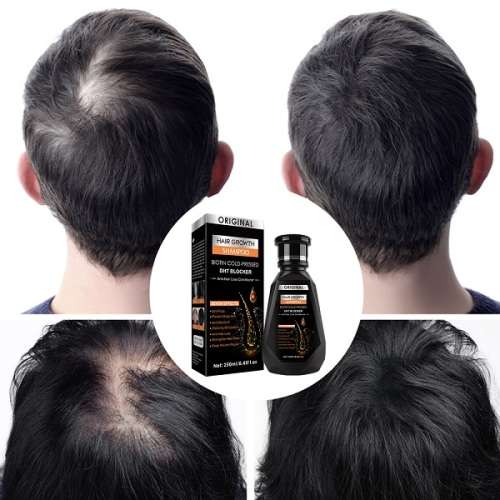 Brilliant Quick Grow Hair Re-Growth and Anti - Hair Loss  Shampoo and Conditioner combo