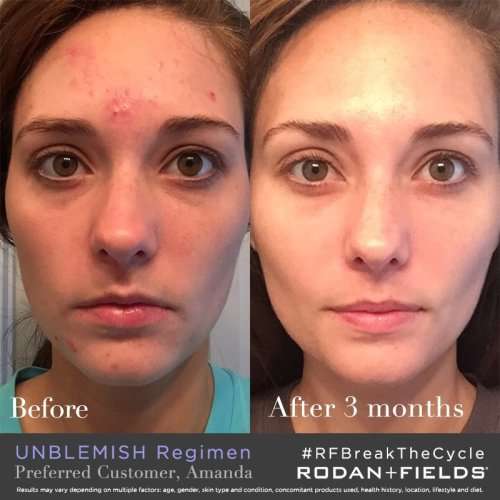 WOKALI GOLD COLLECTION 99% SNAIL ANTI-WRINKLE SKIN REGENERATION and SKIN REPAIR FACE CREAM