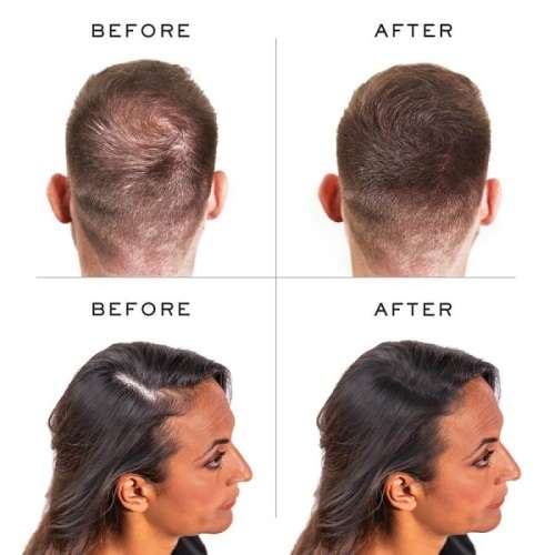 Brilliant and Potent Quick Grow and Anti - Hair Loss Horse Hair Shampoo Treatment