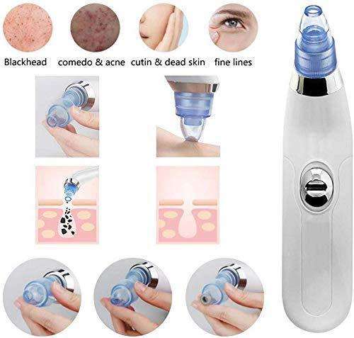 Amazing DermaSuction Deep Pore Cleaning Device