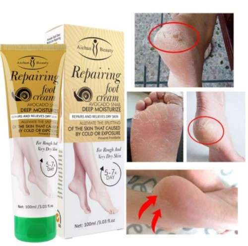 AMAZING !!!!!!!!!!!!  AC DEEP MOISTURIZING and RAPID FOOT and HEEL SKIN REPAIR FOOT CREAM