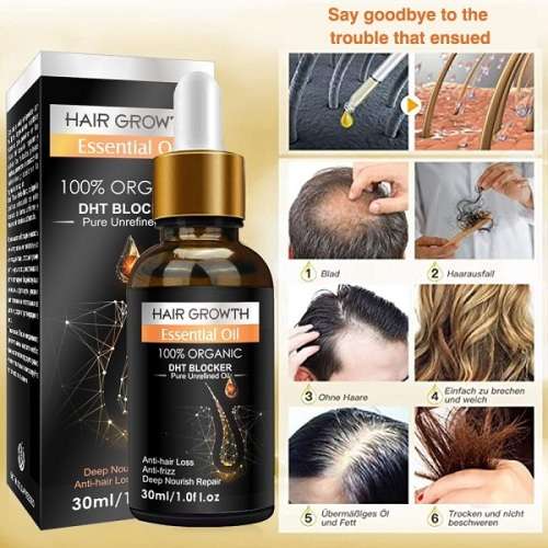 Incredible PEI MEI BIOTIN RAPID HAIR GROWTH and ANTI HAIR LOSS ESSENTIAL OIL