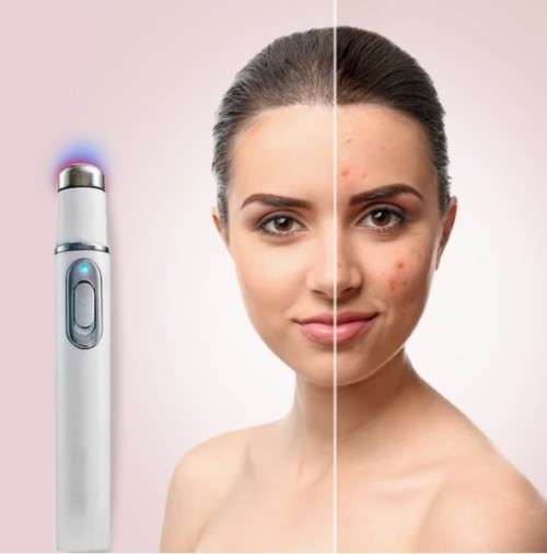 Blue Light Acne, Acne Scars ,Unsightly Veins , Pimples Removal and Repair Laser Therapy Pen