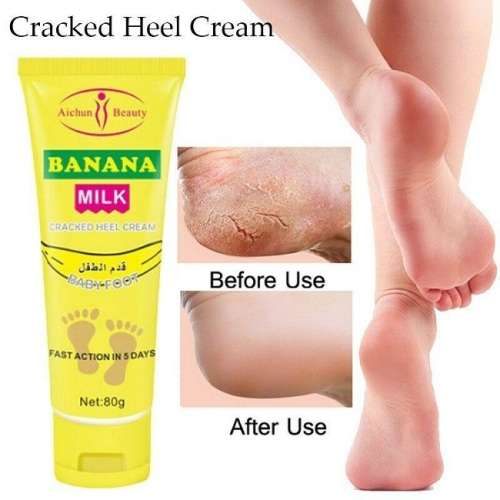 AMAZING !!!!!  5 Day Banana Milk and Shea Butter Cracked Heel Repair and Moisturising Foot Cream