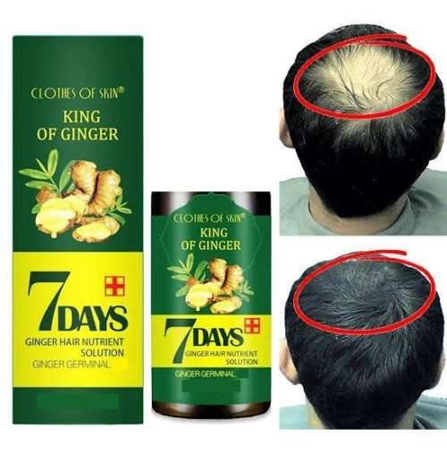 GINGER GERMINAL Anti-hair Loss and Hair Re-Growth Shampoo