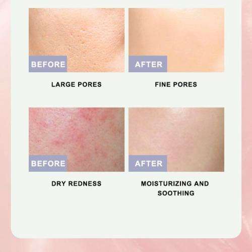 Refreshing Peach   Acne , Grease and Pore Cleaning Face Mask Stick