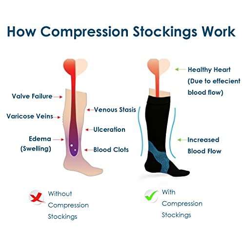 MIRACLE SOCKS  Pain Relief  , Swelling Reduction and Anti - Fatigue Compression Socks