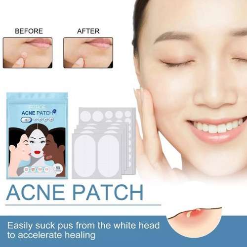 Fast-acting Acne Patch Pimple Remover  (96pcs)