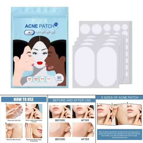 Fast-acting Acne Patch Pimple Remover  (96pcs)