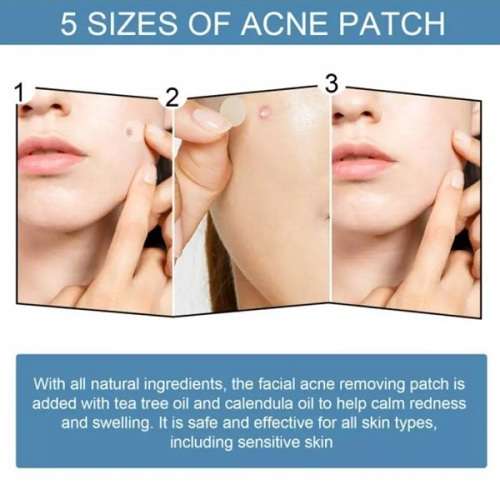 Fast-acting Acne Patch Pimple Remover  (96pcs)