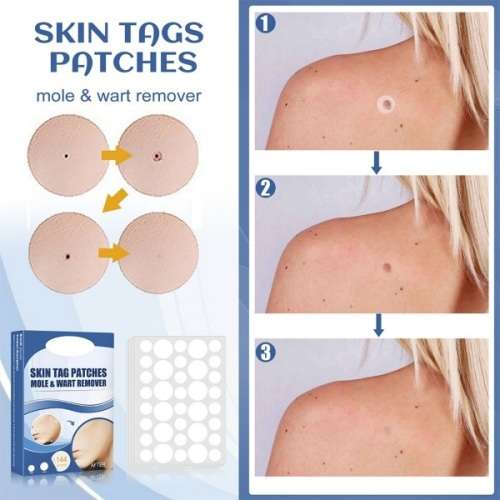 Brilliant & Effective Full Body Skin Tag , Mole & Wart Removal Patches  ( 144 Pcs )