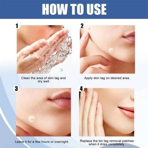 Brilliant & Effective Full Body Skin Tag , Mole & Wart Removal Patches  ( 144 Pcs )