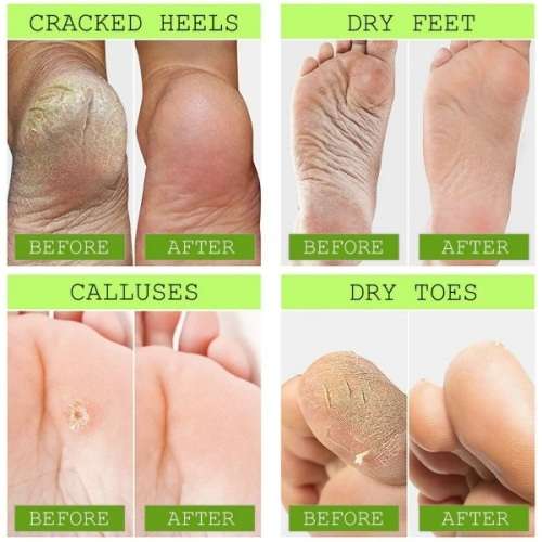 AC High Quality Foot Repair & Fungal Elimination Cream