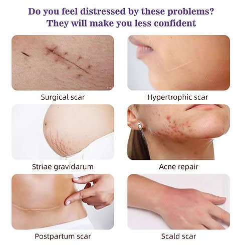 Incredible Lavender Scars Repair Essence