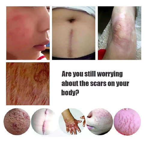 Incredible Lavender Scars Repair Essence