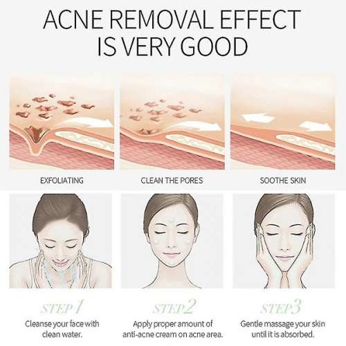 AC Anti Fungal Acne , Acne Scar & Pimple Removal Cream
