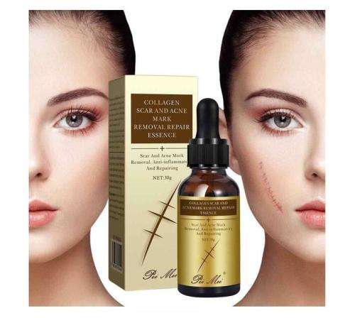 Pure Collagen Scar & Acne Mark Removal & Skin Repair Essence