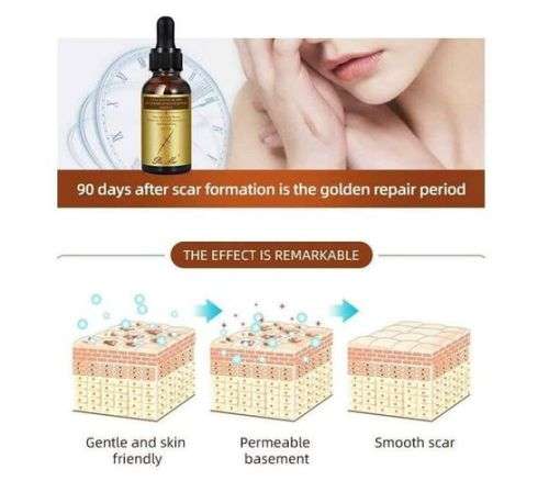 Pure Collagen Scar & Acne Mark Removal & Skin Repair Essence