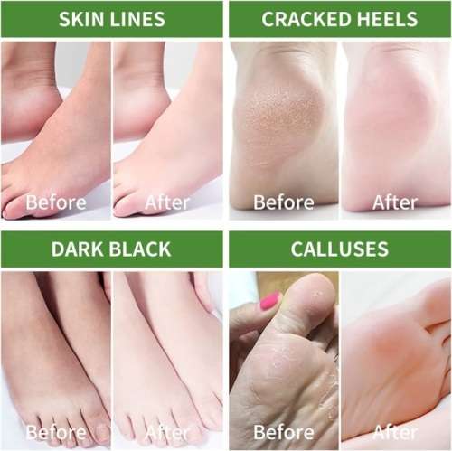 AC  INCREDIBLE BANANA FOOT PEELING & SKIN REPAIR MASK