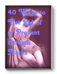 40 Ways to Get Rid of or Prevent Stretch Marks  - Ebook