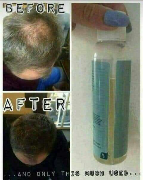 Nutriol Shampoo 125ml