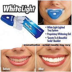 2 ON AUCTION!!! "Teeth whitening light