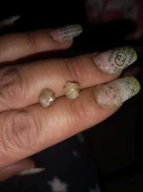 Rose gold natural rough diamond set