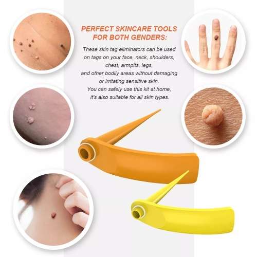 2-in-1 Skin Tag Removal Kit