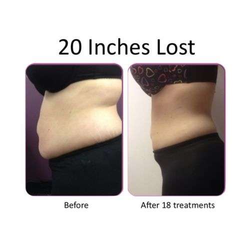 3 in 1 Ultrasonic EMS Infrared Slimming Device including Conductive Gel