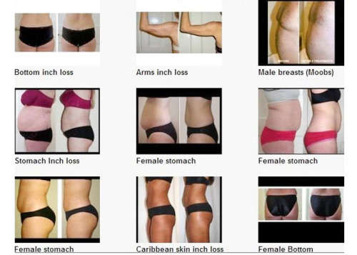 3 in 1 Ultrasonic EMS Infrared Slimming Device including Conductive Gel