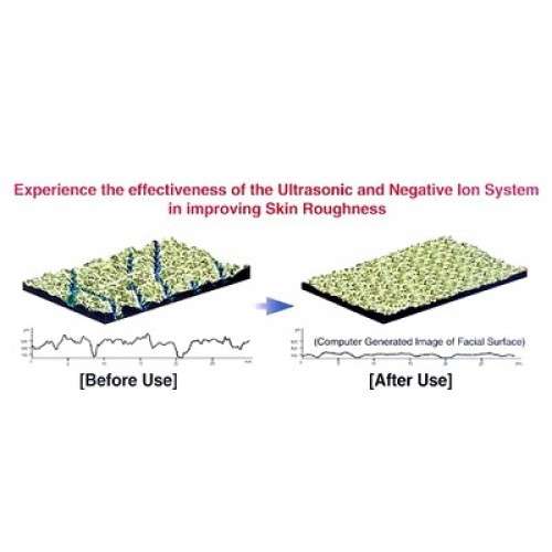 Photon Ultrasonic Light Therapy Skin Rejuvenation Device