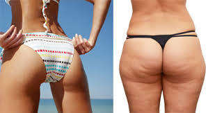 Kick cellulite in the but! 3mths supply! Results within 2 weeks! Javanti Wrap Cellulite Creams