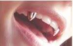 Vampire Fang Hip Hop 14K Gold Plated Single Tooth Grills Removable Teeth Jewelry