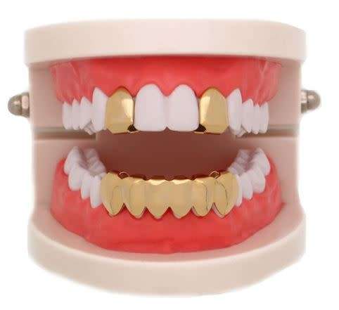 Hip Hop Grill Top & Bottom Gold Plated Dental Braces