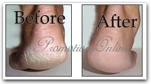 Herbal skin doctor Heel Balm