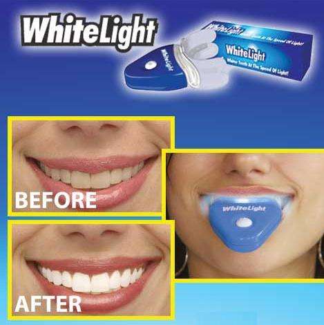 White Ligth Tooth Whitening System
