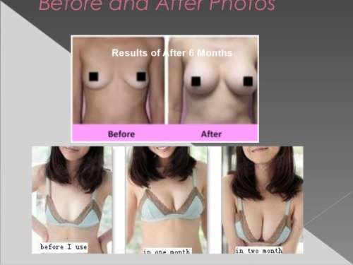 PUERARIA MIRIFICA FOR NATURAL BUST ENLARGEMENT MADE IN JAPAN