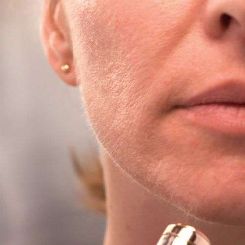 Flawless Facial Hair Remover